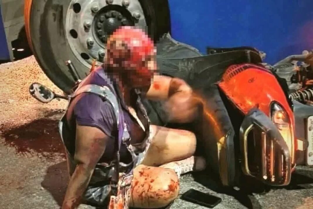 Mujer sufre fuerte accidente en Kanasín, pierde el cuero cabelludo