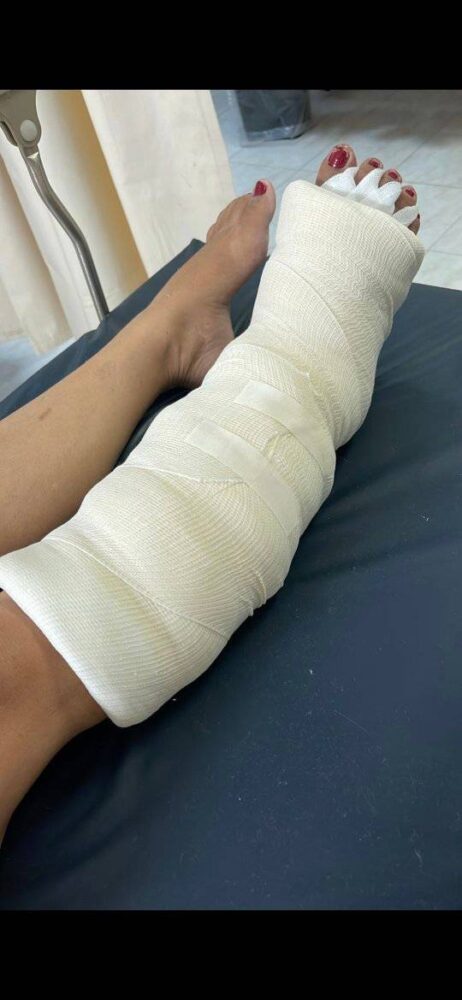Se busca a sujeto demandado por atropellar a una mujer en el centro de Mérida