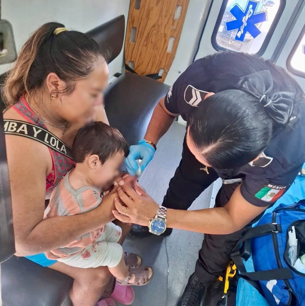 Bebé se le desprende parte de su dedo en Kanasín 