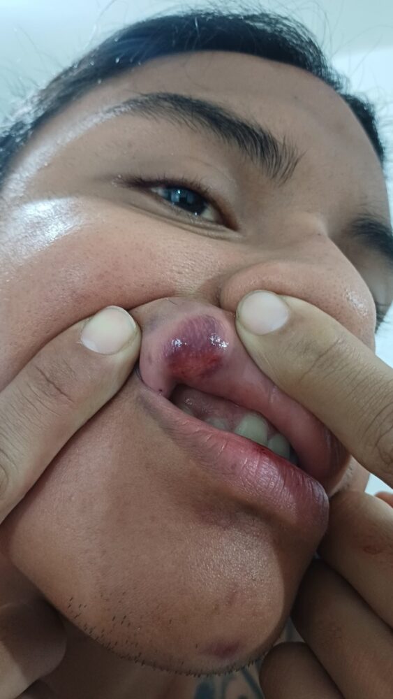 Presunta agresión en cantina Balam de Mérida deja dos clientes lesionados