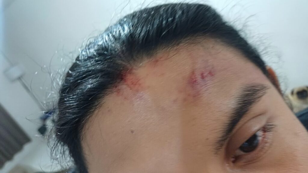 Presunta agresión en cantina Balam de Mérida deja dos clientes lesionados