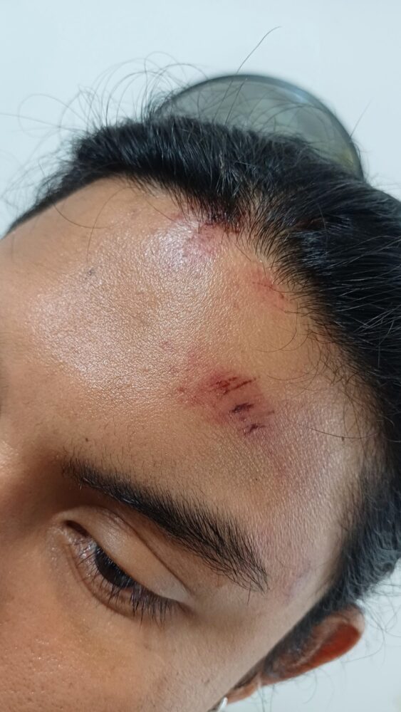 Presunta agresión en cantina Balam de Mérida deja dos clientes lesionados