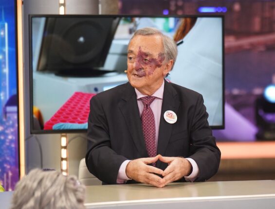 El "milagro" de Barbacid contra el cáncer de páncreas busca financiación para llegar a los hospitales