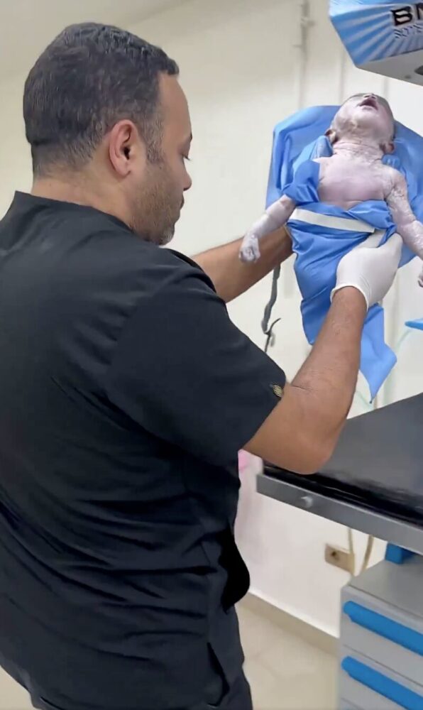 Médico revive a bebé muerto en Brasil