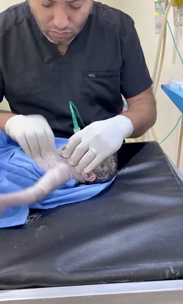 Médico revive a bebé muerto en Brasil