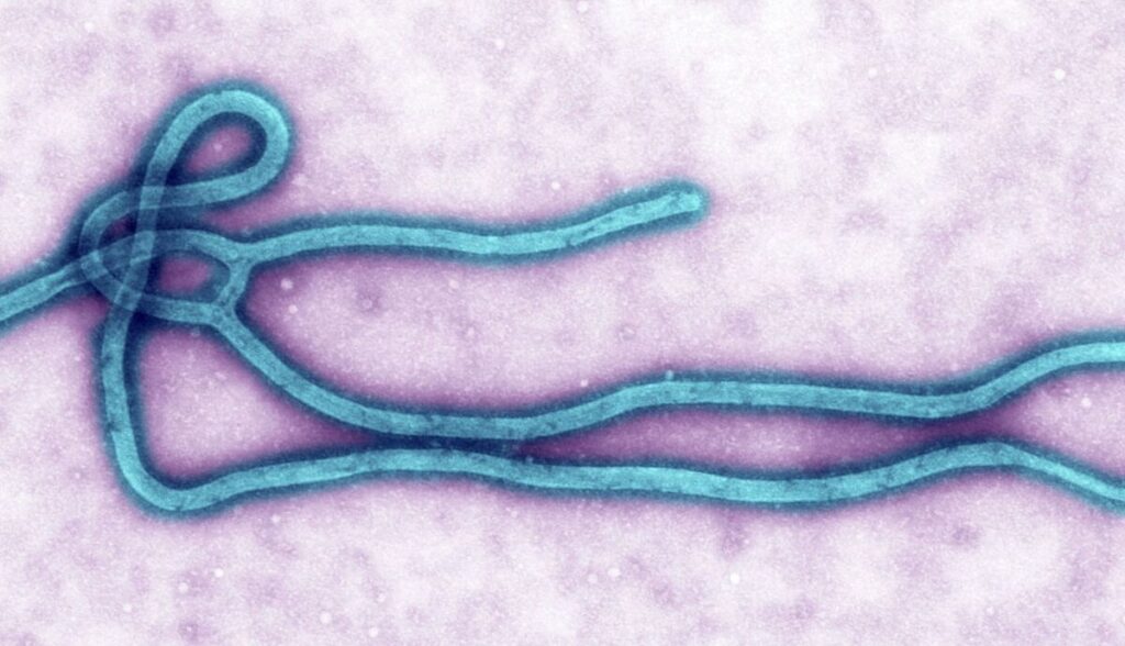 Las autoridades de salud en África confirman un aumento drástico en las cifras de contagios y fallecimientos provocados por el reciente brote del virus del ébola